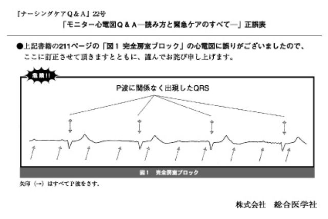 異常波形の読み方 心電図鑑別のチェックポイント 健康 | www.vinoflix.com