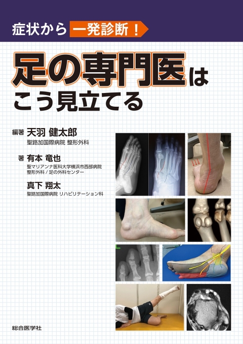 症状から一発診断！　足の専門医はこう見立てる｜株式会社総合医学社