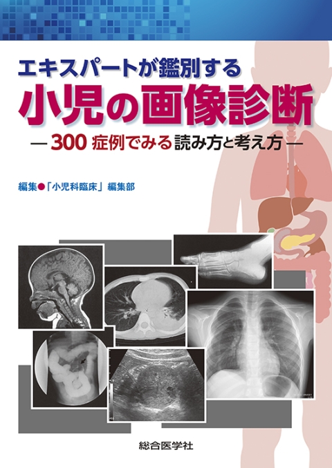 エキスパートが鑑別する 小児の画像診断 —300症例でみる読み方と考え方